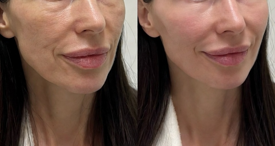 stymulatorytkankowe7